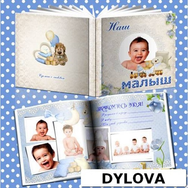 Bayi Titik Biru Album Foto